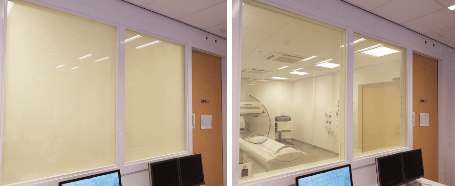 switchable smart glass window in healthcare