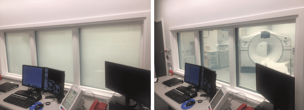 Healthcare smart glass privacy screen